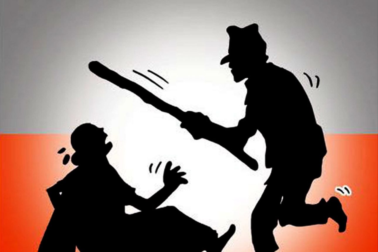 गुल्मीमा श्रीमान्को कुटपिटबाट श्रीमतीको मृत्यु, आरोपी पक्राउ